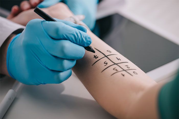 Alerji Tanı ve Tedavisi – klinik tedavi galeri görseli 1