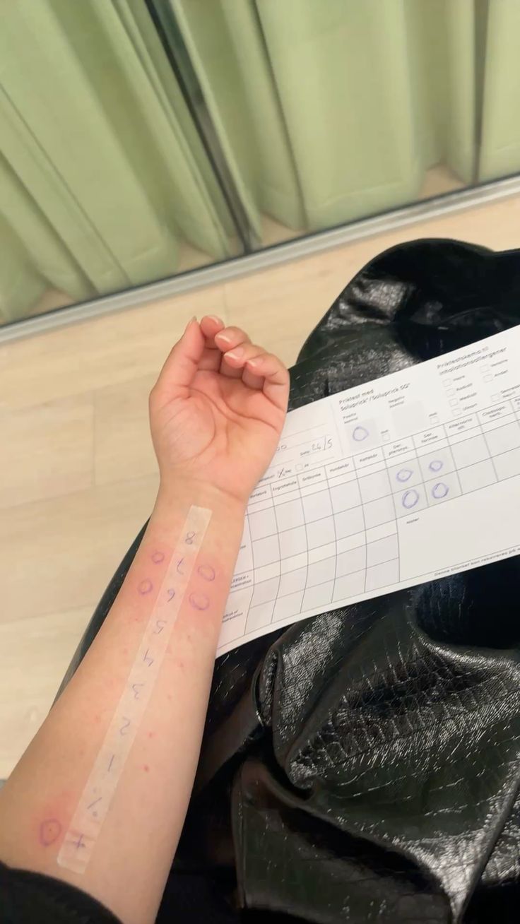 Alerji Tanı ve Tedavisi – klinik tedavi galeri görseli 3