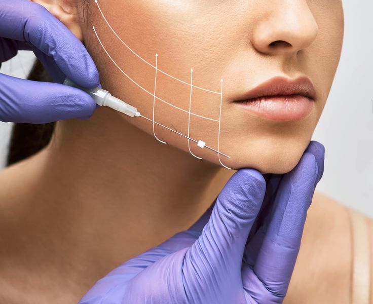 Ameliyatsız Yüz Estetiği – klinik tedavi galeri görseli 2