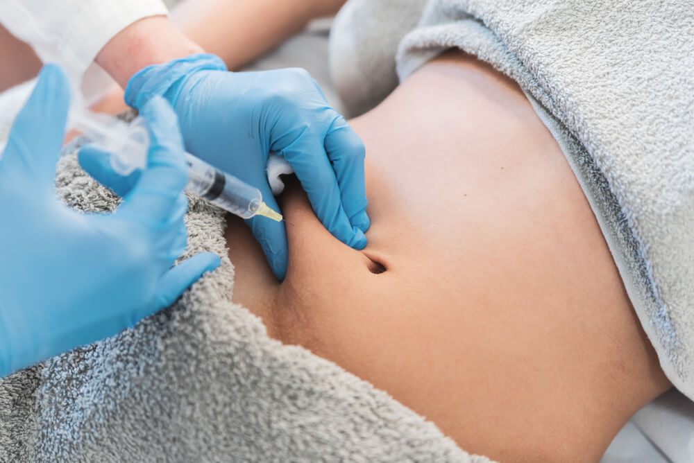 Enzimatik lipoliz medikal estetik görseli