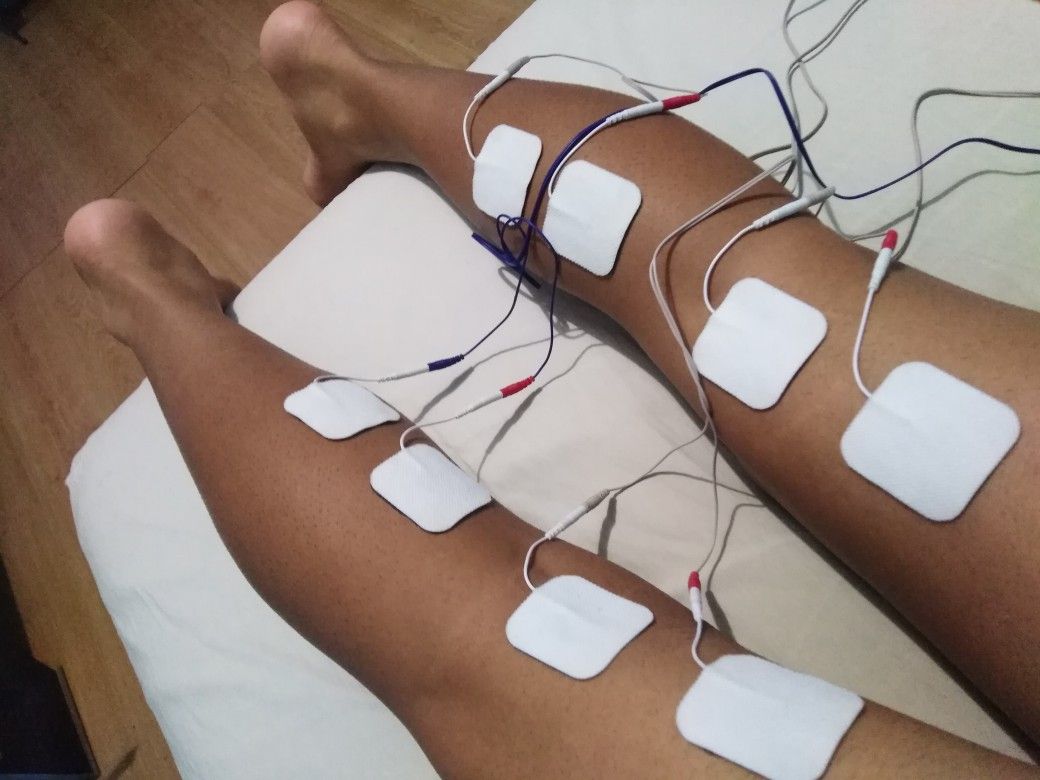 Fibromiyalji Ağrısı – klinik tedavi galeri görseli 1